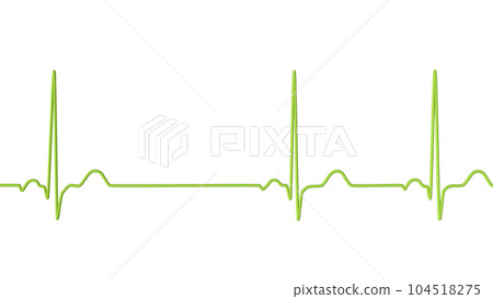 Electrocardiogram ECG displaying sinus arrhythmia, 3D illustration 104518275