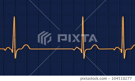 Electrocardiogram ECG displaying sinus arrhythmia, 3D illustration 104518277