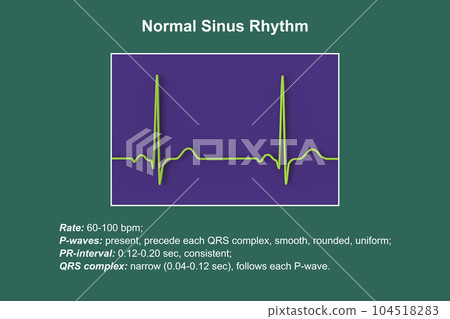 A normal electrocardiogram, 3D illustration A normal electrocardiogram, 3D illustration 104518283