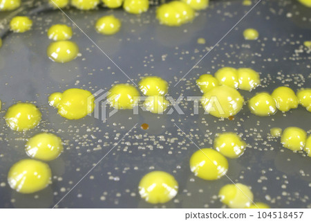 Bacteria grown from skin smear Bacteria grown from skin smear 104518457