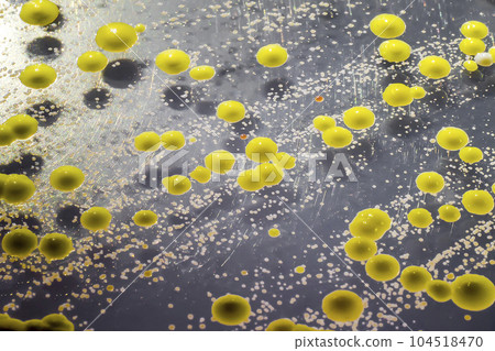 Bacteria grown from a skin smear, colonies of Micrococcus luteus and Staphylococcus epidermidis Bacteria grown from a skin smear, colonies of Micrococcus luteus and Staphylococcus epidermidis 104518470