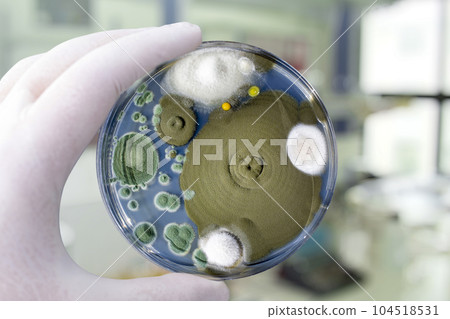 Colonies of different mold fungi grown from indoor air 104518531