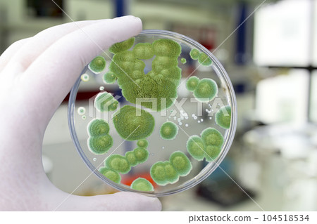 Colonies of different mold fungi grown from indoor air 104518534
