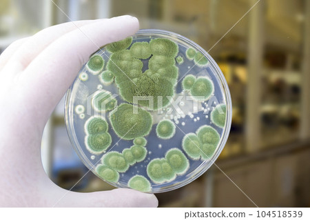 Colonies of different mold fungi grown from indoor air 104518539
