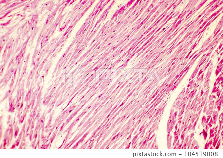 Heart hypertrophy photomicrograph 104519008