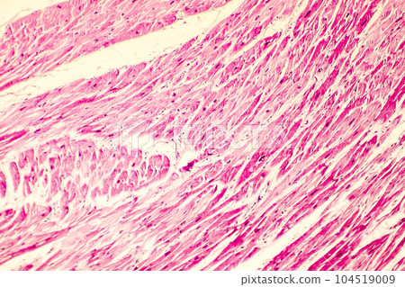 Heart hypertrophy photomicrograph Heart hypertrophy photomicrograph 104519009