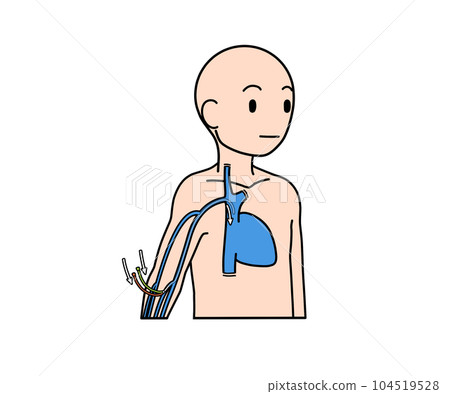 PICC導管 104519528