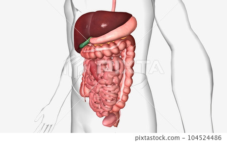 Abdominal adhesions are bands fibrous tissue formed after surgery between the abdominal organs and surrounding tissues 104524486