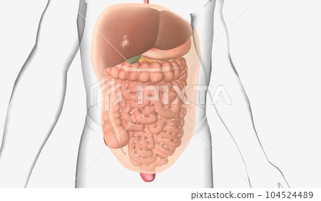 Abdominal adhesions are bands fibrous tissue formed after surger 104524489