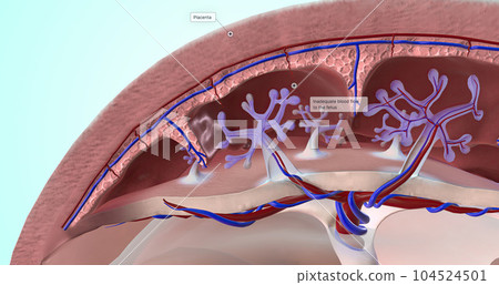 Abnormal Blood Supply to Placenta 104524501