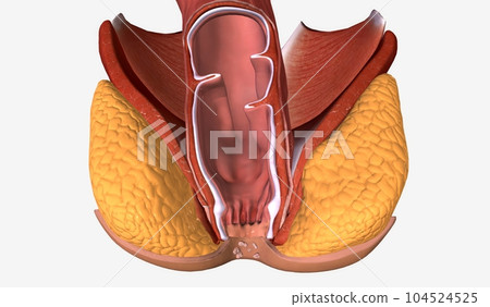 Anal warts are painless, growths along the skin near the anal canal Anal warts are painless, growths along the skin near the anal canal 104524525