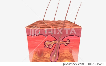 Anal Warts in Skin Tissue 104524529