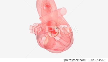 The Properly functioning heart valve 104524568