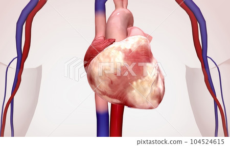 Atrial Fibrillation Consequences 3d render 104524615