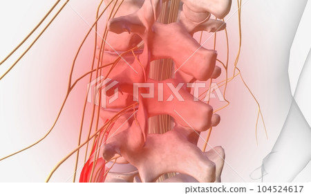 Back and Lower Limb Pain Back and Lower Limb Pain 104524617
