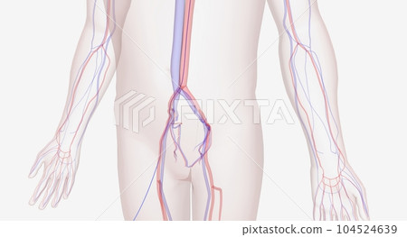 Will insert a catheter through a large artery near the groin or Will insert a catheter through a large artery near the groin or 104524639
