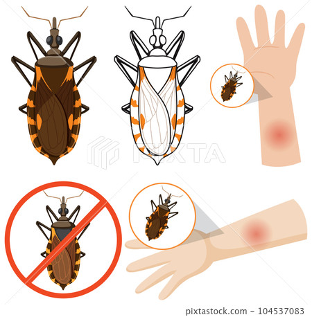 Human arm swollen from kissing bug bite 104537083