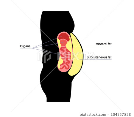 Visceral fat diagram 104557838