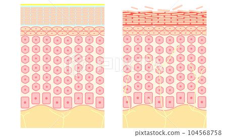 Structure of human skin, moist and dry skin Structure of human skin, moist and dry skin 104568758