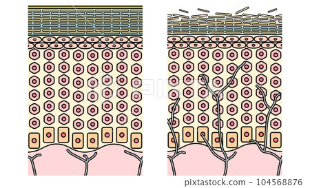 Structure of moist and dry skin (human skin) 104568876