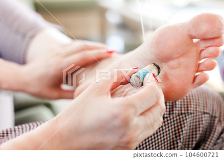 foot Moxibustion treatment. woman applying moxa to patient. Alternative traditional chinese medicine 104600721