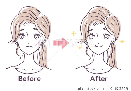 Face wound erasing treatment before and after person woman illustration material 104623229