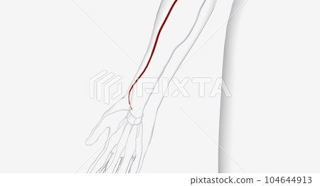The radial artery is a major artery in the forearm that supplies blood to the lower arm and hand. The radial artery is a major artery in the forearm that supplies blood to the lower arm and hand. 104644913