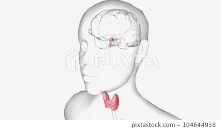 Hyperthyroidism is an overproduction of thyroid hormones 104644938