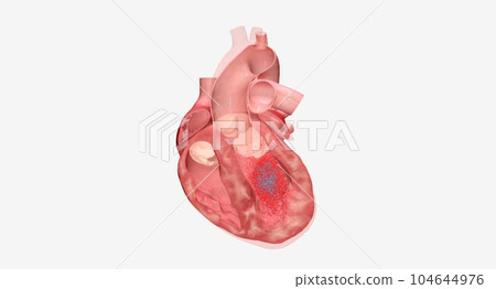 The Heart is Failure Medications 104644976
