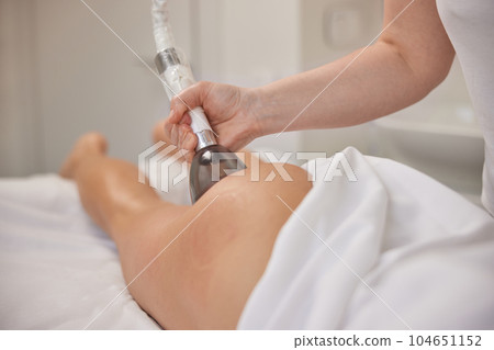 Cosmetology, vacuum roller massage, modern medical. In clinic, vacuum body massage, problems areas slimming, suitable equipment for body care professional, lpg massage procedure, anti-cellulite Cosmetology, vacuum roller massage, modern medical. In clinic, vacuum body massage, problems areas slimming, suitable equipment for body care professional, lpg massage procedure, anti-cellulite 104651152