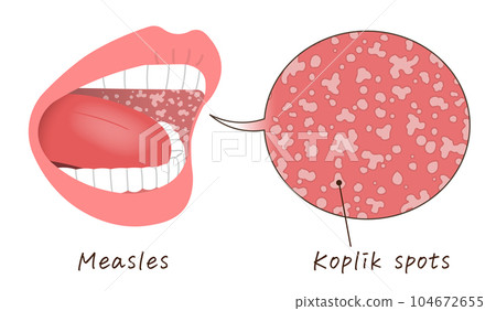 bad breath, vector, vectors 104672655