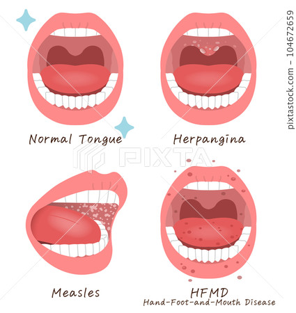 bad breath, vector, vectors 104672659