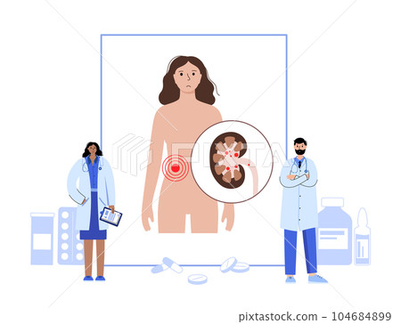 Kidney stones treatment Kidney stones treatment 104684899