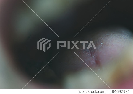 tongue, mouth, oral 104697985