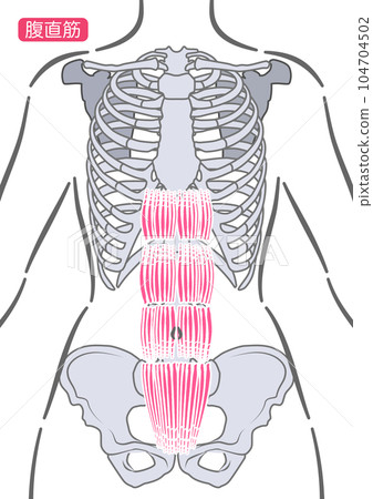女性腹直肌 104704502