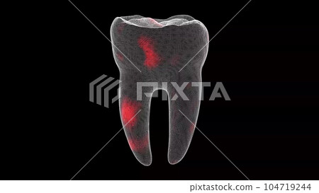 3D tooth. Toothache Scanning Interface. HUD Tooth analyze. Medical Anatomy concept. Digital tooth anatomy model. Oral health care concept. For title, text, presentation. 3d animation. 104719244