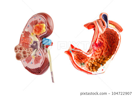 Kidney and stomach model isolated on white background. Chronic kidney disease, treatment urinary system, urology, Estimated glomerular filtration rate eGFR. 104722907