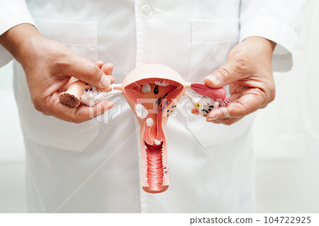 Uterus, doctor holding anatomy model for study diagnosis and treatment in hospital. Uterus, doctor holding anatomy model for study diagnosis and treatment in hospital. 104722925