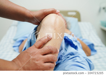 Doctor checking Asian elderly woman patient with scar knee replacement surgery in hospital. 104723285