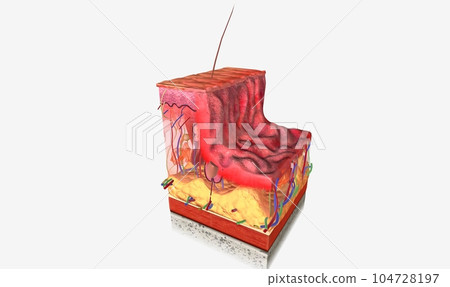 Partial Thickness Wound in Skin Tissue Partial Thickness Wound in Skin Tissue 104728197