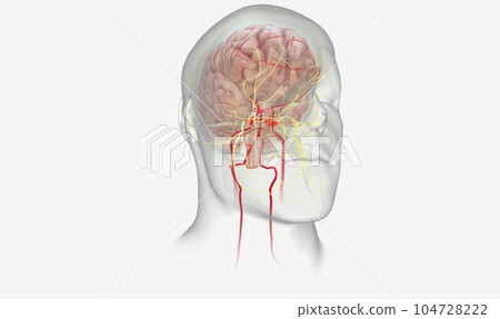Migraine is a neurological disorder characterized by recurring, Migraine is a neurological disorder characterized by recurring, 104728222