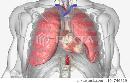 Lung cancer is a type of cancer that begins within the lungs 104746819