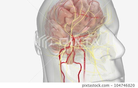Migraine is a neurological disorder characterized by recurring, 104746820