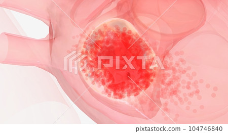 The repaired heart valve is working properly The repaired heart valve is working properly 104746840