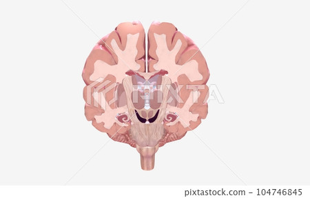 Multiple Sclerosis Lesions in Brain Multiple Sclerosis Lesions in Brain 104746845