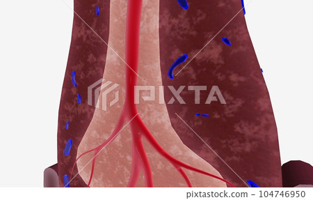 The spleen supports the lymphatic system by filtering blood and producing white blood cells, or lymphocytes 104746950