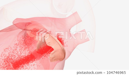 The mitral valve is located between the left atrium and the left ventricle. The mitral valve is located between the left atrium and the left ventricle. 104746965