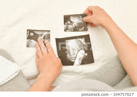 Pregnant woman holding 4D ultrasound image. Expectation of a child 104757027