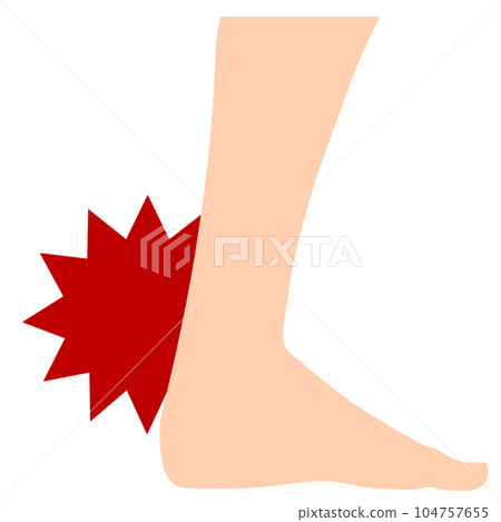 跟腱 104757655