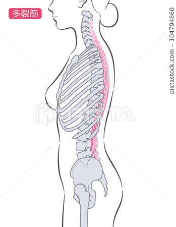 女性多裂肌側 104794660